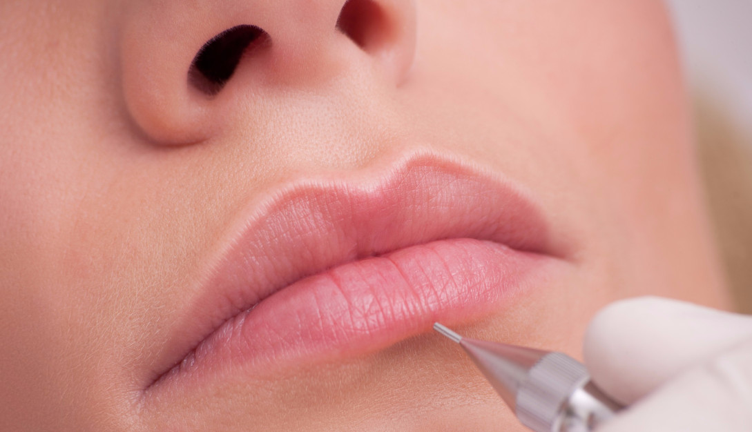 Фото 3. Процедура контурного макияжа губ