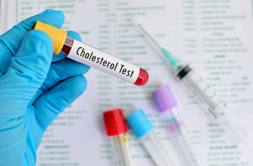 Чтобы понять, повышен ли холестерин у мужчины или женщины надо сдать несколько анализов, которые покажут соотношение ЛПНП и ЛПВП 